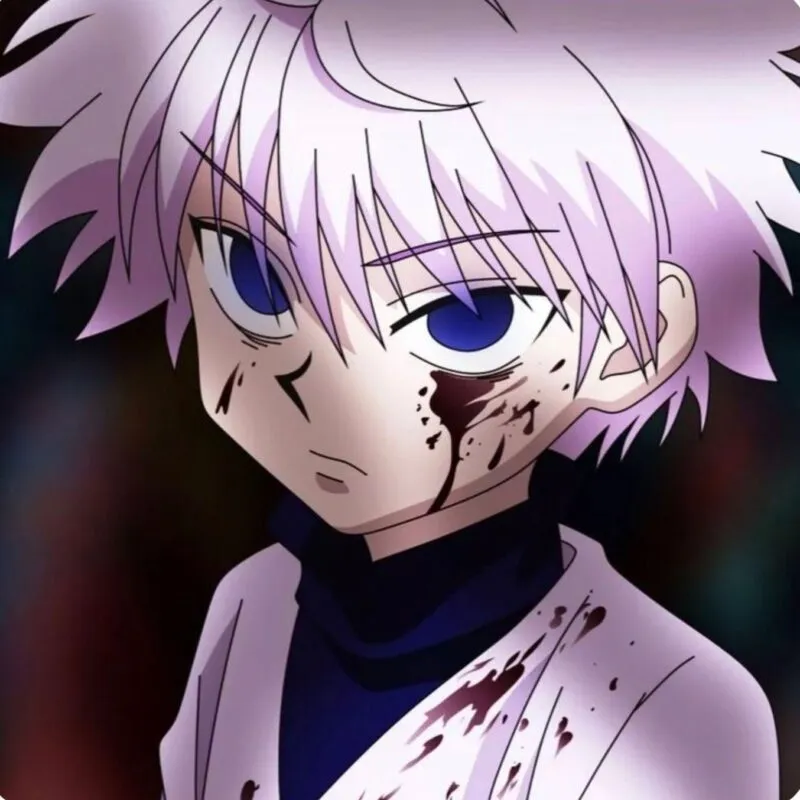 Khám phá kho tàng ảnh killua avatar ngầu nhất mọi thời đại